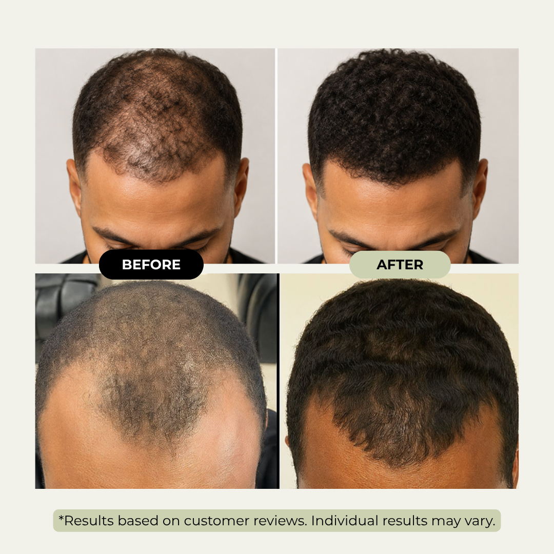 Batana Hair Oil