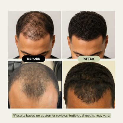 Batana Hair Oil