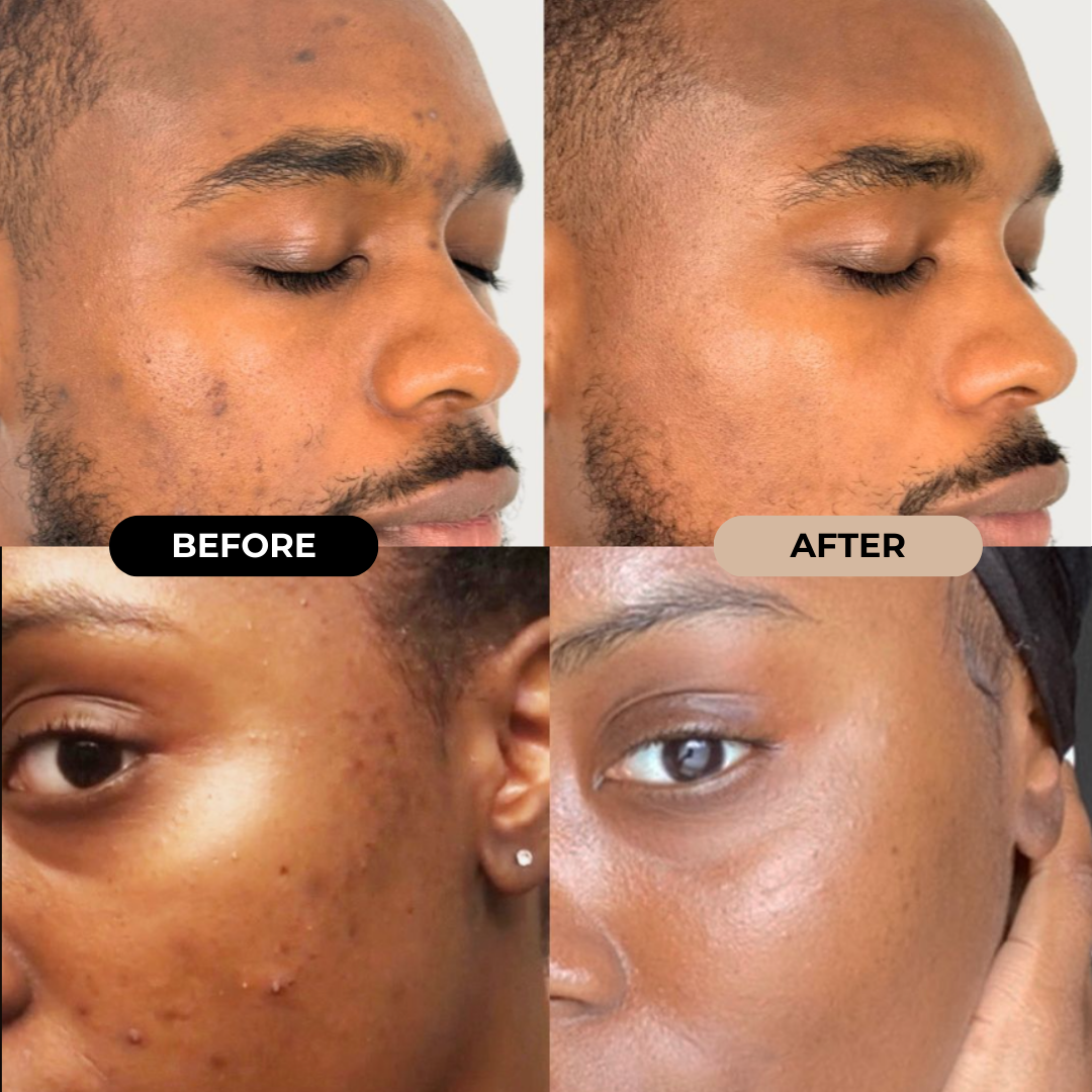 PDRN Brightening Serum