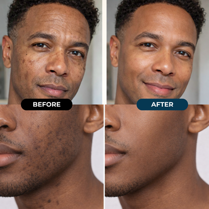 Dark Spot Fade Cream